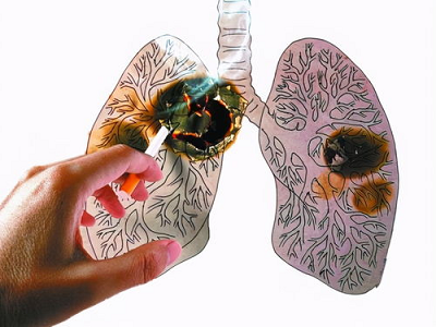 传统中医辨证施治给慢阻肺患者一次康复的机会