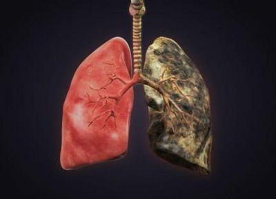 早发现,早治疗,对肺癌患者至关重要