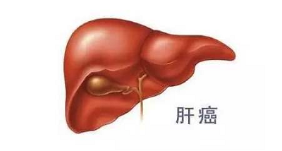 重庆中医肝癌医馆|抗肝癌之路上的得力“助手” 中医治疗