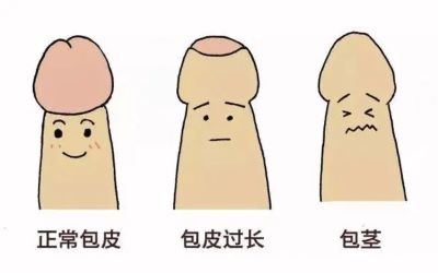 重庆阴茎癌老中医:阴茎癌会不会传染呢?包皮过长需警惕!