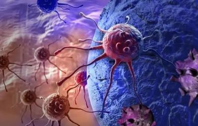肿瘤患者除瘤心切,老中医罗登祥:其实可以先考虑中医治疗