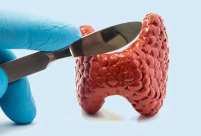 【神奇中医】甲状腺结节会癌变?4个问题带你了解甲状腺结节