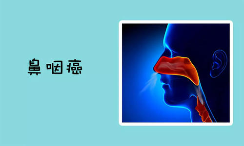 该如何挽救复发的鼻咽癌？中医有疗效吗？
